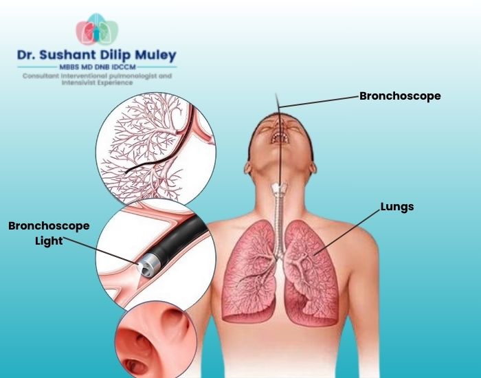 New Techniques and Technologies in Lung Health